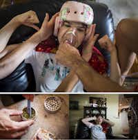 Kara Zartler punches herself in the head with both fists as her father Mark places a medical mask over her nose and mouth and fills it with marijuana vapor in an effort to control her fit of self-abuse on March 18 in Richardson. (Smiley N. Pool/The Dallas Morning News)