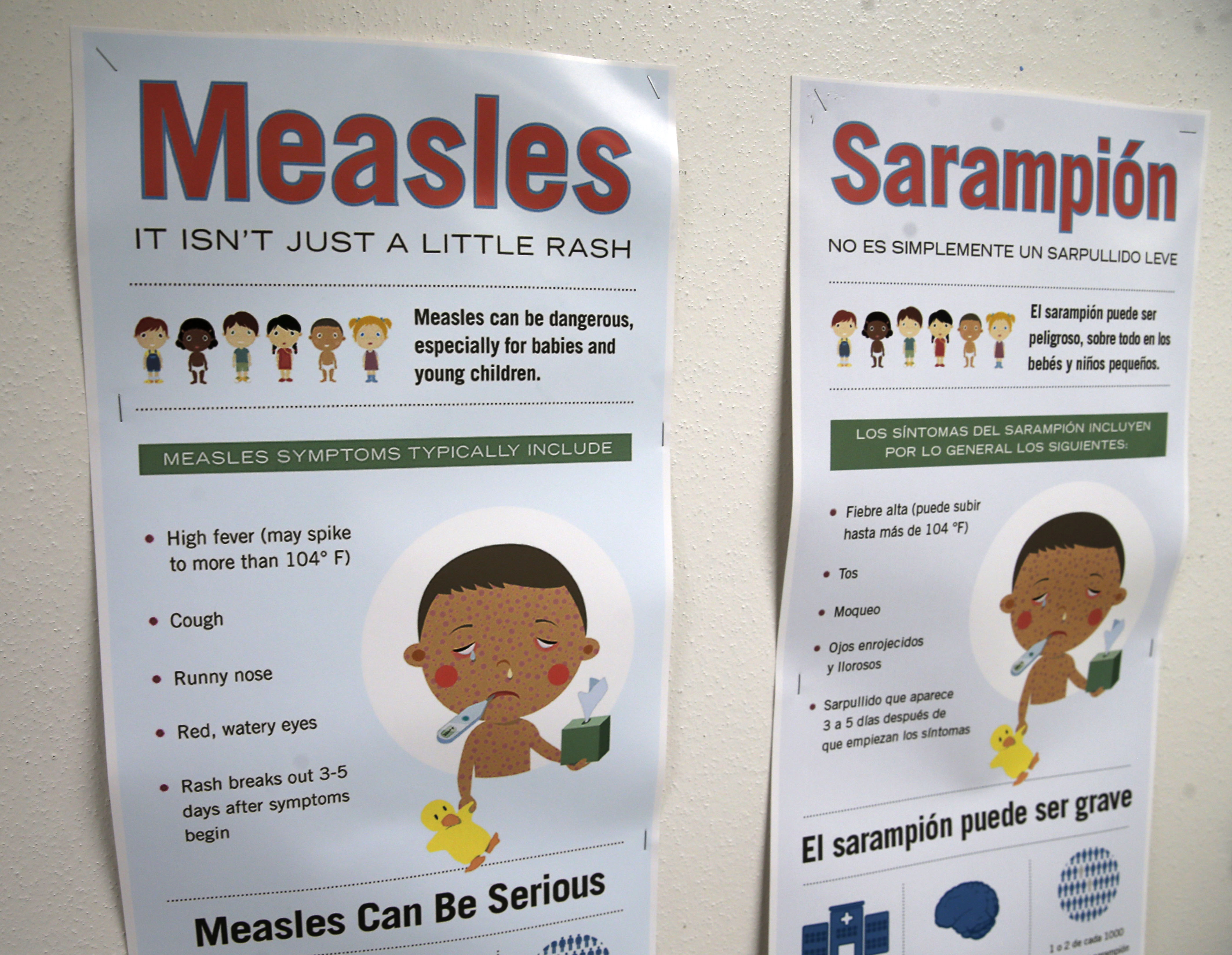 How can those vaccinated still get measles? Although effective, it's no  sure thing – Orange County Register