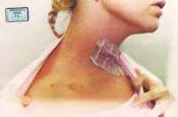 The stab wound to Routier's neck in 1996. Prosecutors said it was self-inflicted.